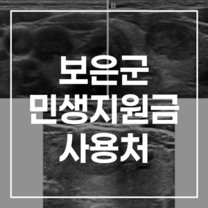 2026 보은군 민생지원금 사용처: 대상, 신청, 카드 총정리